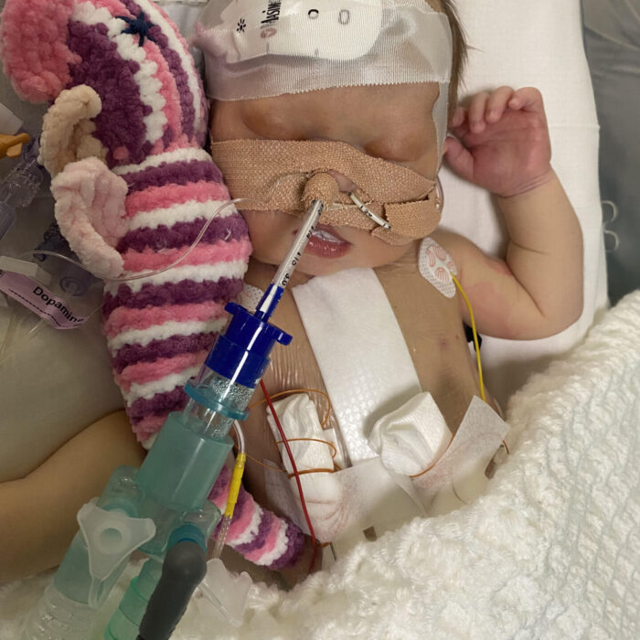 My baby needed life-saving heart surgery at SIX DAYS OLD after nurse spotted something strange in scan picture,’ reveals Wales mum, 32